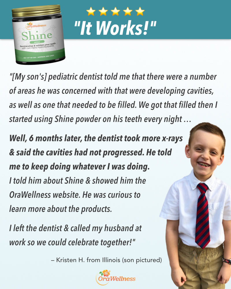Shine—Remineralizing Tooth Whitening Powder with Hydroxyapatite